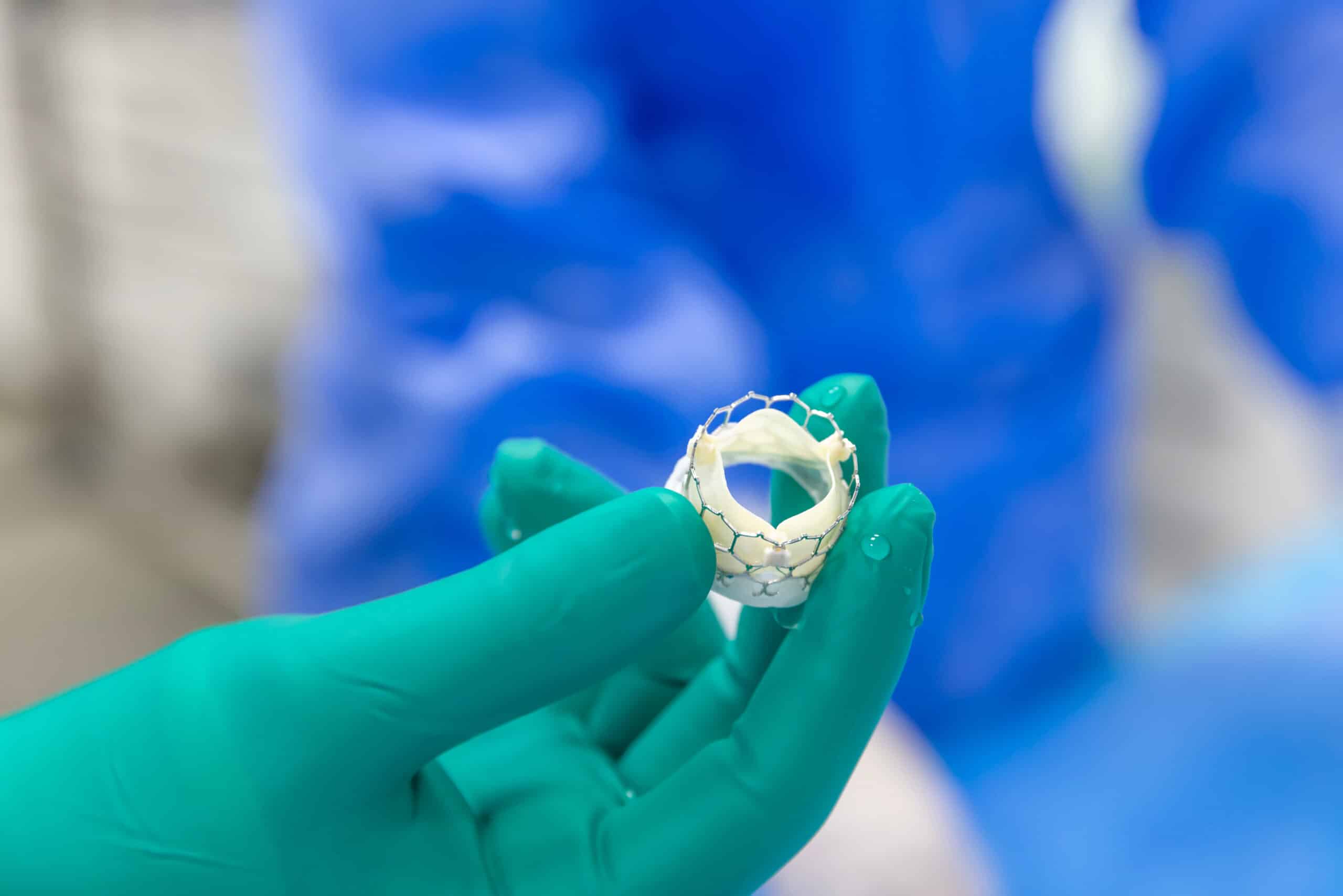 A gloved hand holds a small cylindrical medical device with a white mesh structure likely a heart valve or stent against a blurred blue background.
